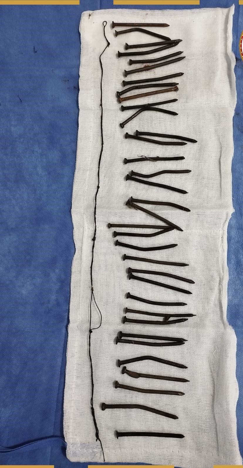 المسامير المستخرجة من معدة مريضة المسامير المستخرجة من معدة مريضة