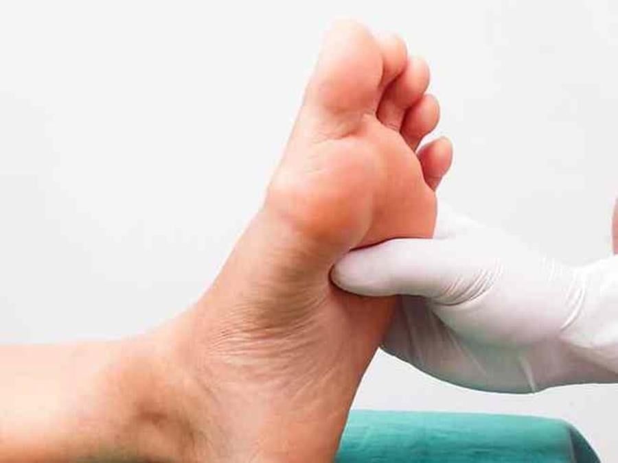 7 أسباب وراء الإصابة بتنميل أصابع القدم 