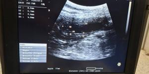 مستشفى
      الطب
      البيطري
      بجامعة
      قنا
      تستقبل
      حالة
      نادرة
      لكلبة
      جيرمان
      شيبرد
      تعاني
      من
      نزيف
      بالبول
      وخمول
      مزمن