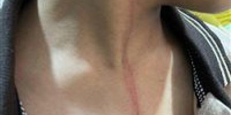 تحقيق
      عاجل
      في
      واقعة
      تعدٍ
      على
      تلميذ
      داخل
      مدرسة
      بميت
      غمر
      في
      الدقهلية