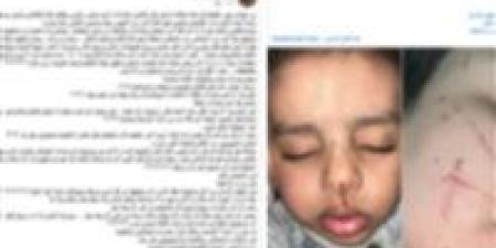 الداخلية
      تكشف
      تفاصيل
      ضرب
      سيدة
      وطفلها
      على
      يد
      جيرانها
      في
      الغربية