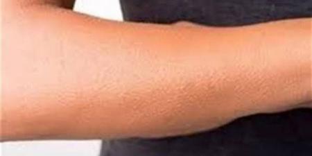 تفسير رؤية الجلد في المنام وعلاقتها بوجود بعض الأصدقاء المنافقين