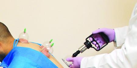فئات لا تناسبها الحجامة.. أخصائية تحذر وتكشف معلومة هامة بشأن الأطفال