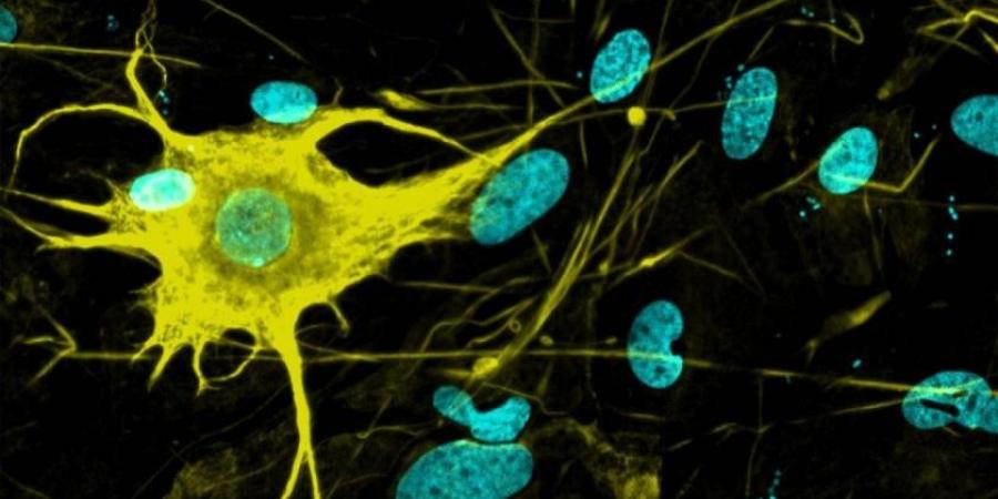 زراعة خلايا المخ بالمختبر لعلاج الزهايمر وباركنسون