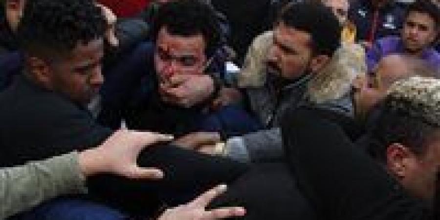 خناقة
      بسبب
      مياه..
      مشاجرة
      بالأسلحة
      والألعاب
      النارية
      بالعمرانية