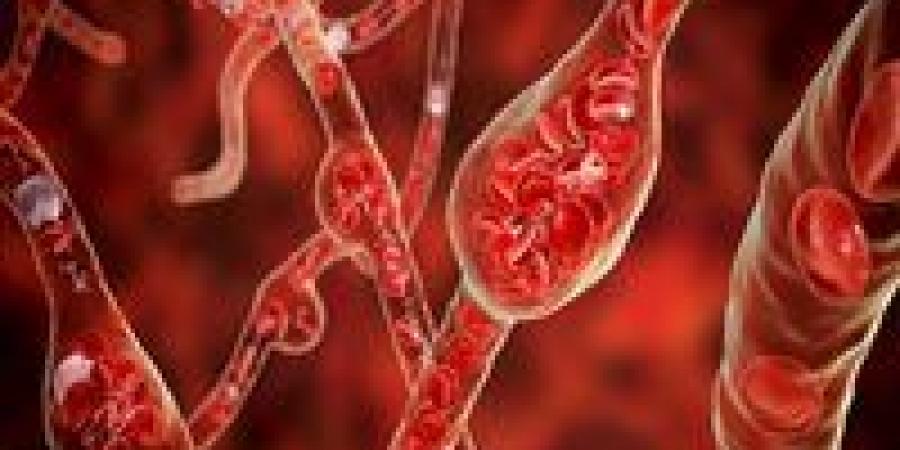 تحذيرات
      علمية
      دولية..
      عامل
      بيئي
      خفي
      وراء
      ارتفاع
      ضغط
      الدم