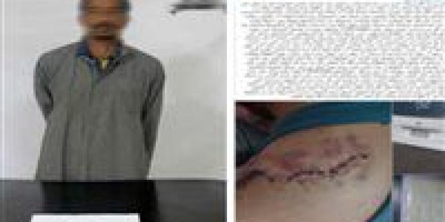 ضبط سائق ميكروباص بعد تعديه على راكب بـ«كتر» وإصابته قي الذراع بمنطقة غمرة