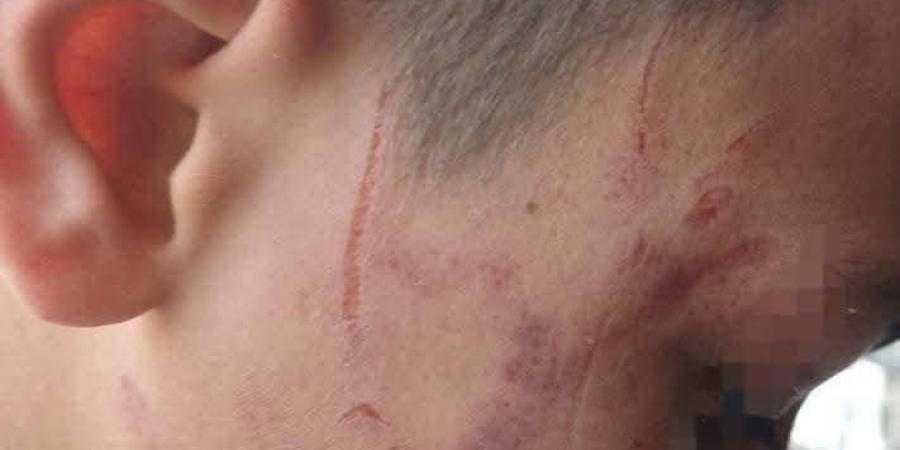 داخل
      مدرسة
      دار
      السلام
      بسوهاج..
      معلمة
      تضرب
      تلميذًا
      بخرطوم
      الأنبوبة
      والتعليم
      تفتح
      تحقيقًا
      عاجلًا