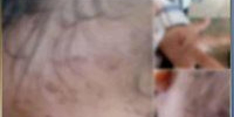 شخص
      يتهم
      طليقته
      ووالدتها
      بتعذيب
      نجلهما
      في
      الشرقية..
      والداخلية
      تكشف
      الحقيقة