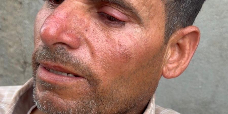 “آخر
      وصية
      قبل
      الرحيل”..
      عريس
      لم
      يكمل
      عامه
      الأول
      في
      الزواج
      بين
      ضحايا
      حادث
      طريق
      توشكى
      بأسوان