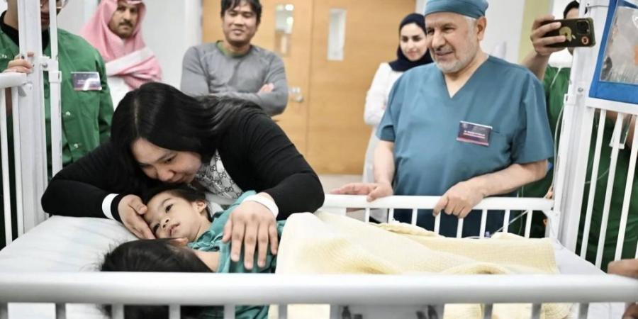 بدء عملية فصل التوأم الملتصق الفلبيني أوليفيا وجيانا