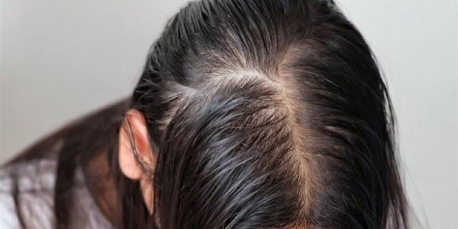 سيروم
      القرنفل
      لتقوية
      الشعر
      وإعادة
      انباته