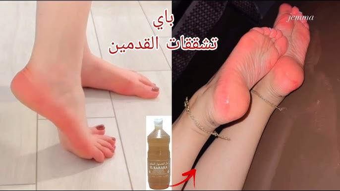 طرق فعالة لتنعيم القدمين من التشقق
